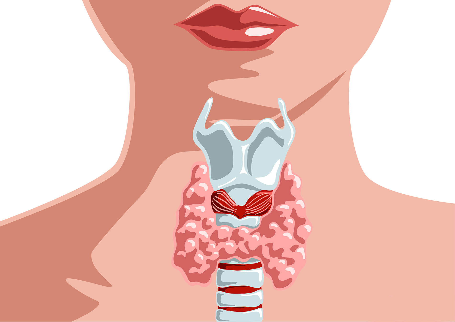 Тиреоидит: что такое аутоиммунное заболевание щитовидной железы?