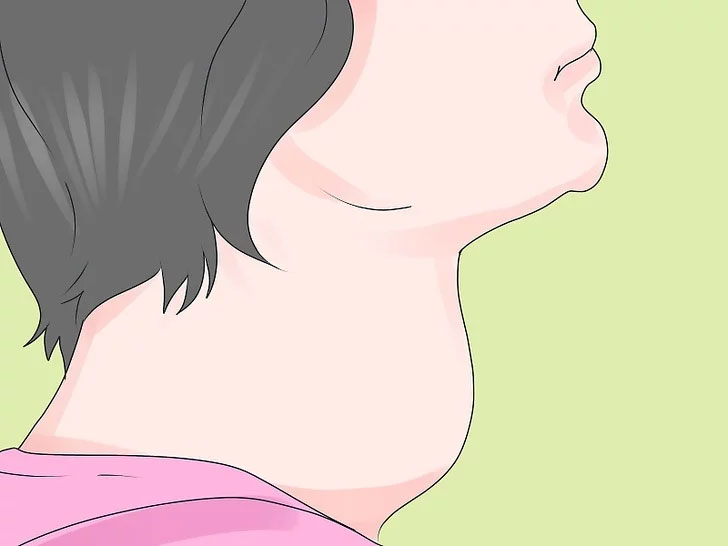 щитовидка заболевание щитовидной железы, как лечить тиреоидит 